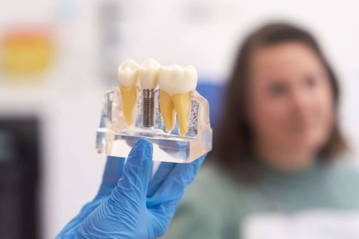 Rebuilding Your Smile with Dental Implants