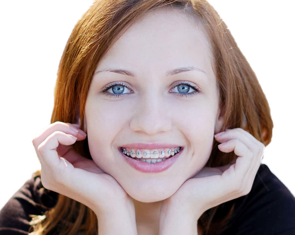 braces in Danville