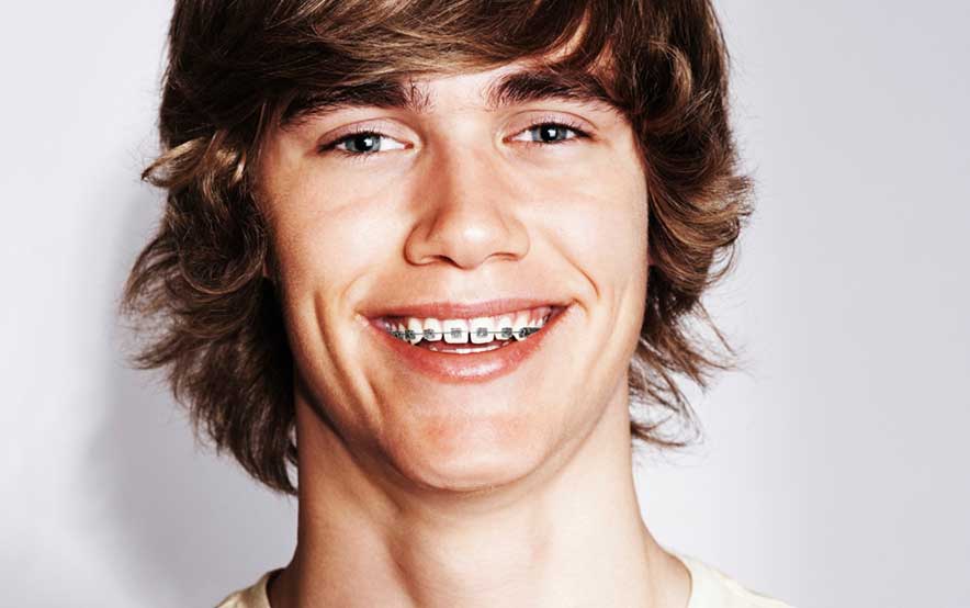metal braces