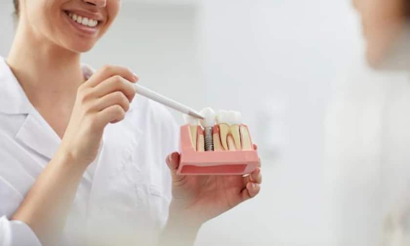 Dental Implants in Danville