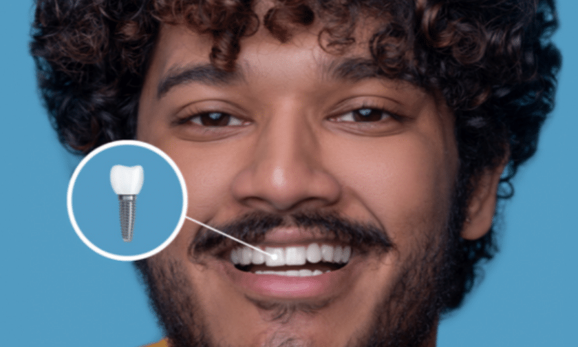 Why Should You Consider Getting Dental Implants