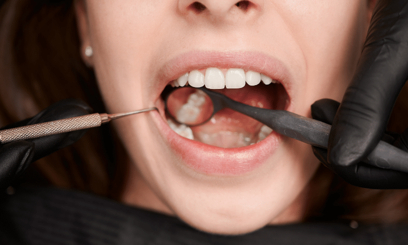 What Causes Tooth Sensitivity