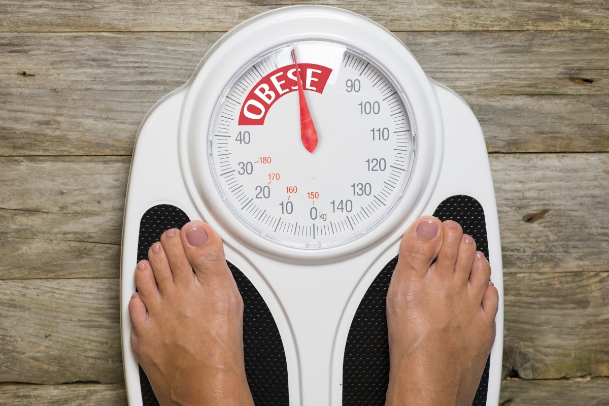 Obesity