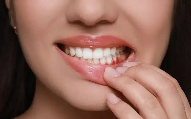 Signs of Gum Problems & When to Visit a General Dentist