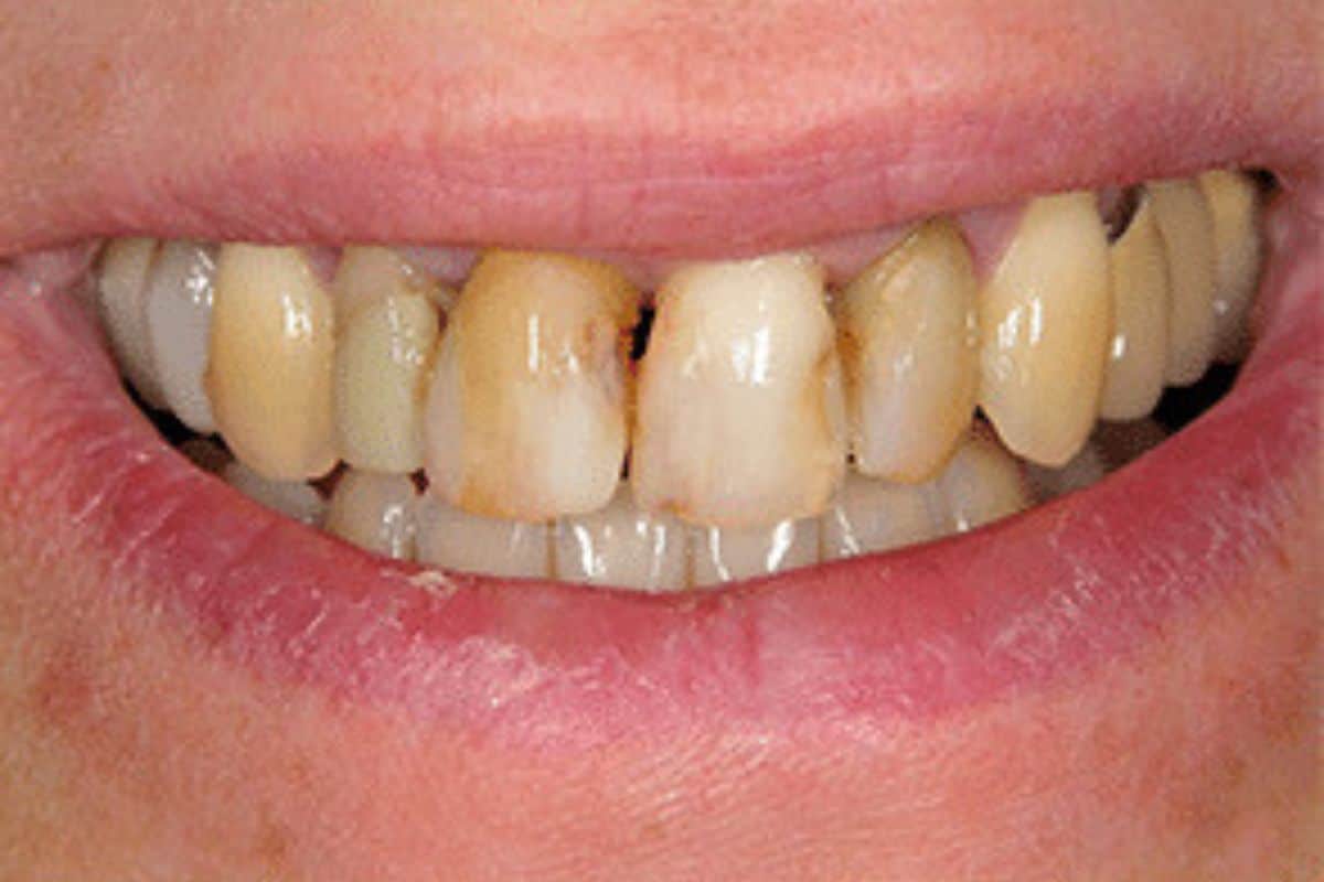 dentist in danville